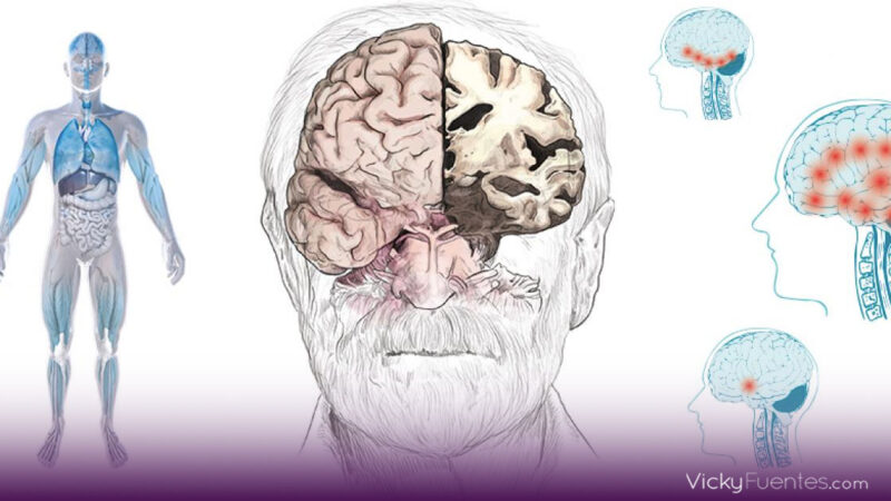 Nuevos Factores de Riesgo de Alzheimer y Demencia: Prevención 2024